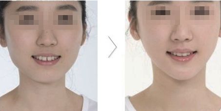 哪家醫(yī)院在北京具有卓越的醫(yī)美科技和服務(wù)？歐洲醫(yī)學(xué)中心、北京協(xié)和、北大人民醫(yī)院等公立單位有何特色？