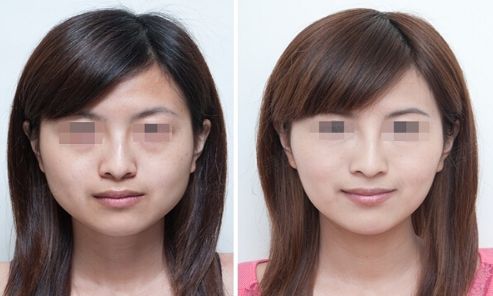 煙臺(tái)市三甲整形醫(yī)院排名匯總，哪家好？