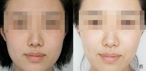 日照市前十一家信譽較高的整形美容醫(yī)院排行