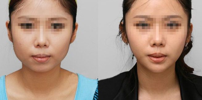 蘭州哪家整形醫(yī)院口碑好？看看排名榜單！