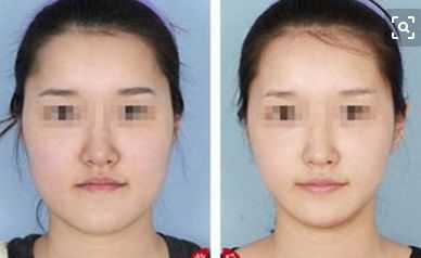 舒緩按摩，喚醒肌膚活力光彩