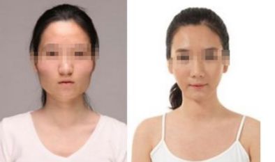 2024年臺(tái)州地區(qū)優(yōu)秀整形醫(yī)院推薦