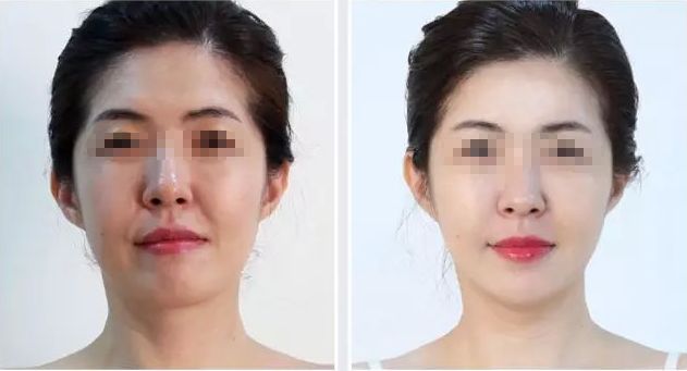 濟(jì)寧哪家整形醫(yī)院評(píng)價(jià)好，口碑排名靠前的有哪些？