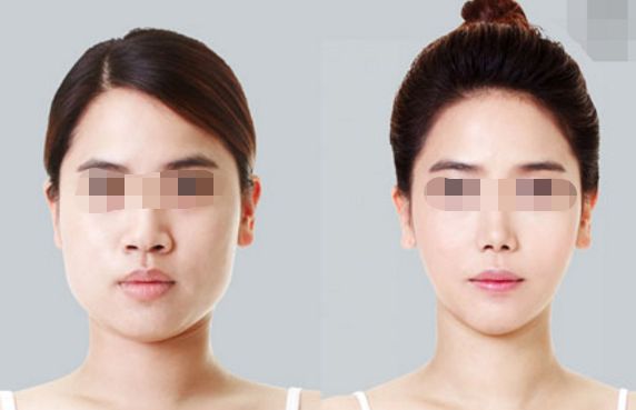 張家口市一家醫(yī)療美容醫(yī)院特惠來襲，多重優(yōu)惠等你來享！