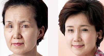 珠海整形醫(yī)院哪家好？排名榜前五都有哪些醫(yī)院？