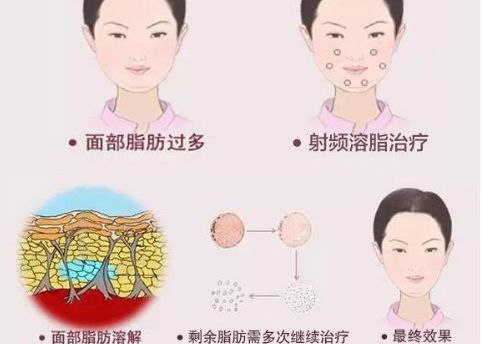 徐州二院整形美容科專家評價(jià)及服務(wù)項(xiàng)目介紹，陶常波醫(yī)生特長領(lǐng)域一覽