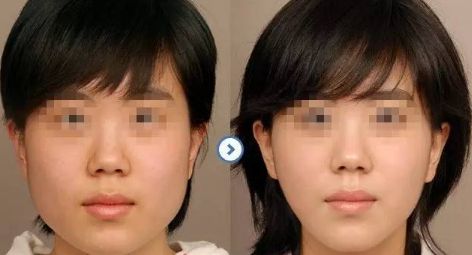 【揭秘】合肥私立整形醫(yī)院人氣TOP榜單！