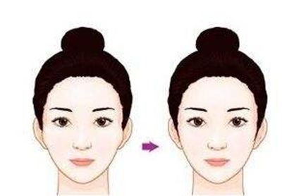 深圳哪家醫(yī)院的隆鼻效果好？醫(yī)生口碑怎么樣？