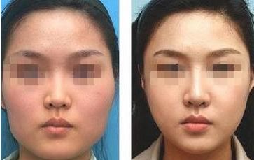 【2024】濱州去眼袋醫(yī)院排名前六強，最新醫(yī)院詳解！