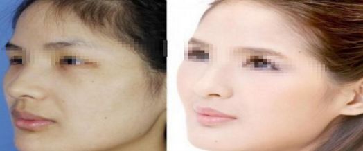 上海微整形醫(yī)院哪家好？