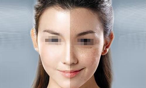 衡陽雅美14周年慶vip專場：寶尼達(dá)私享會，玻尿酸買2送2優(yōu)惠限時(shí)開啟