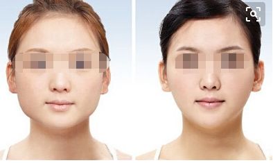 濟(jì)南減肥醫(yī)院有哪些？