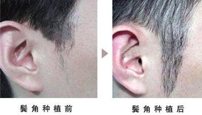 熱瑪吉第四代和第五代差異及價格指南