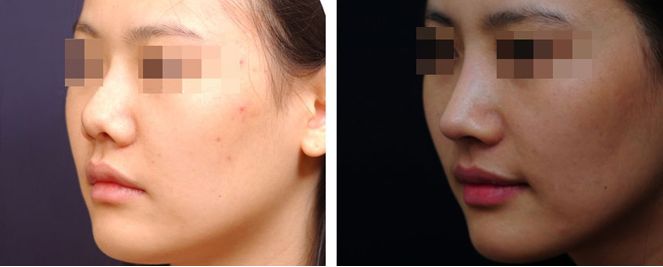 福建整形醫(yī)院TOP10評選結(jié)果即將揭曉