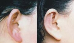 推薦：北京哪家隆鼻醫(yī)院口碑比較好？