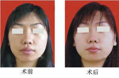 杭州哪家整形醫(yī)院口碑比較好，推薦浙江醫(yī)美排行榜前十佳