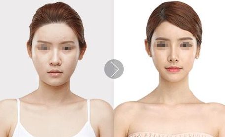 攀枝花中西醫(yī)結合醫(yī)院美容科技術分享，術后反饋給你。