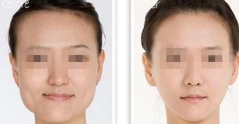 黑龍江三甲整形醫(yī)院熱門(mén)榜單，前三強(qiáng)大揭秘！