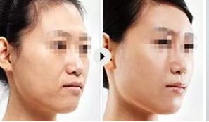 上海頂尖美容整形醫(yī)院精選，讓你真正了解排行榜