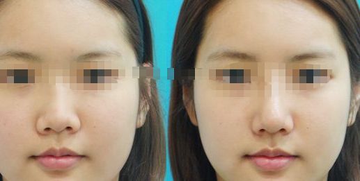 成都市吸脂手術(shù)在哪兒可以做？