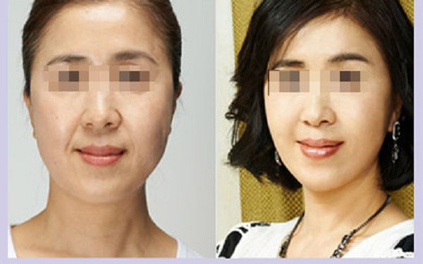 珠海知名整形醫(yī)院盤點，哪家更受歡迎？