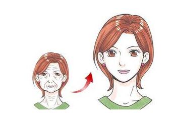 虞冬梅醫(yī)生雙眼皮修復(fù)效果分享：手術(shù)后真實圖賞析