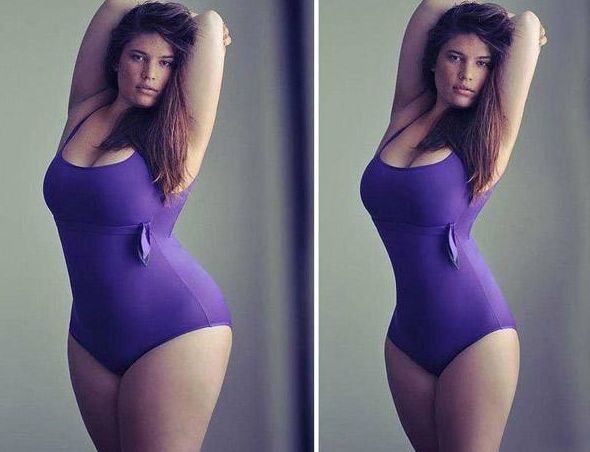 武漢葉子醫(yī)療美容醫(yī)院的專業(yè)項(xiàng)目及費(fèi)用公布！在同行中區(qū)別明顯的機(jī)構(gòu)！