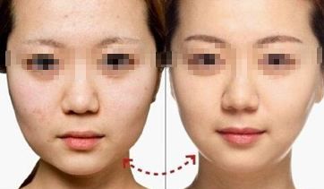 武漢整形醫(yī)院2023年排名揭曉！超人氣醫(yī)院霸榜前四，你一定沒想到！