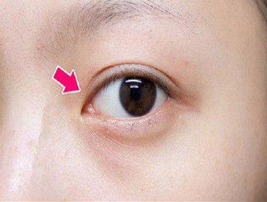 揚(yáng)州哪家整形醫(yī)院技術(shù)好？