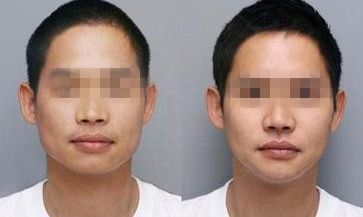 上海市做雙眼皮排名前列的醫(yī)院是哪家