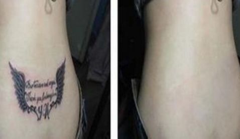 雙眼皮手術(shù)醫(yī)院推薦，一站式解決開眼角問題