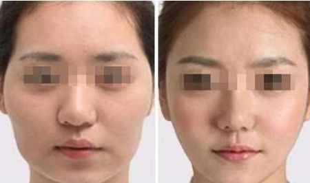 武漢熙蒙整形醫(yī)院信譽(yù)如何醫(yī)生介紹、費(fèi)用更新了！