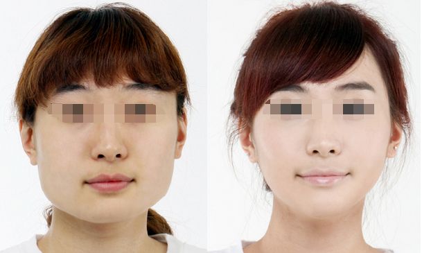 楊冪劉愷威傳授唇部護(hù)理秘訣，打造嬌嫩雙唇