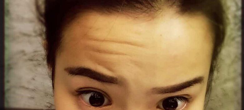 深圳哪幾家醫(yī)美整形醫(yī)院口碑最好？