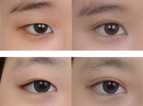 北京名媛傳奇醫(yī)療美容正規(guī)詳情 科室介紹與口碑評價