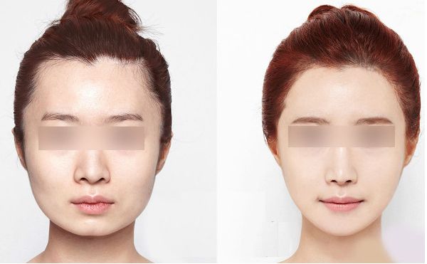 哈爾濱微整形醫(yī)院榜單發(fā)布，全面揭秘哪家醫(yī)院更受歡迎