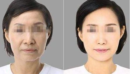 梅州皮膚科醫(yī)院排名前五名匯總