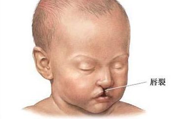 內(nèi)蒙古附屬醫(yī)院點(diǎn)陣激光體驗(yàn)分享，了解一下這項(xiàng)先進(jìn)技術(shù)吧！價格表附后！