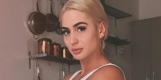 艾拉絲提玻尿酸價格及持久度詳解