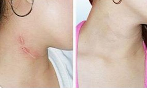 滄州京美醫(yī)療美容服務(wù)項(xiàng)目一覽表，請(qǐng)您參考