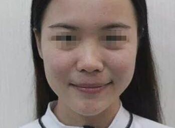 南充疤痕整形醫(yī)院排名精選，助你尋找完美去疤痕之旅