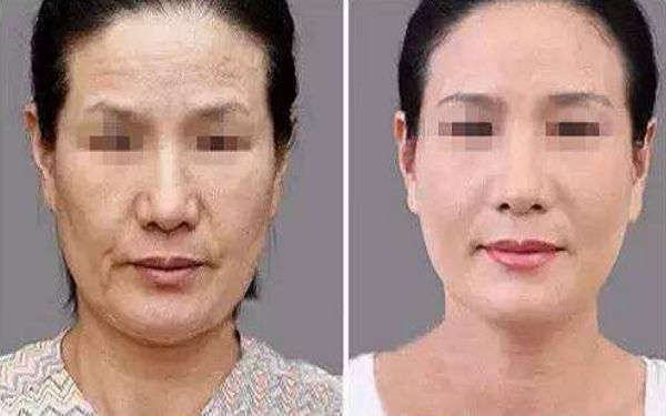 2024年連云港整形醫(yī)院專業(yè)排行榜出爐，你知道嗎？