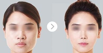 廣州耳再造醫(yī)院綜合評(píng)價(jià)曝光，醫(yī)療技術(shù)領(lǐng)跑全國(guó)