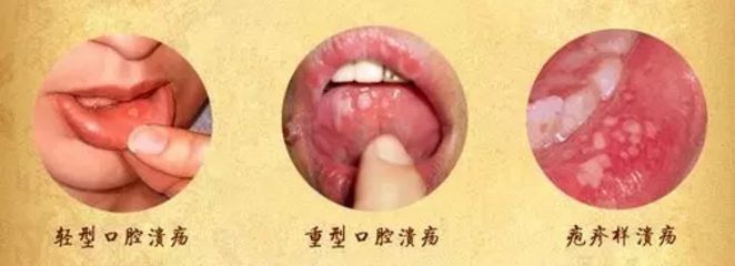 北京眼袋整形醫(yī)院排名大揭秘，最佳去眼袋選擇！