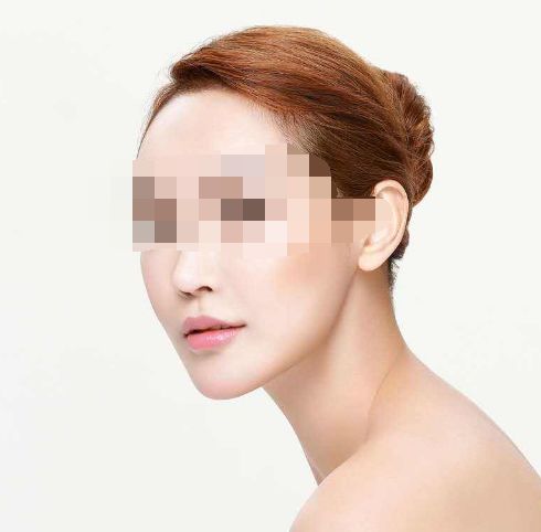 2024成都專業(yè)整形醫(yī)院推薦匯總