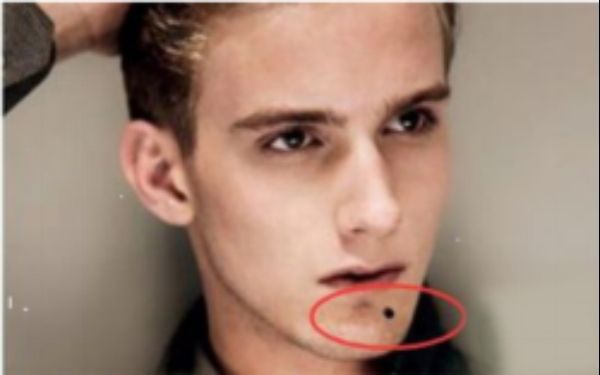 北海市人民醫(yī)院整形科眼袋手術(shù)效果如何？技術(shù)實力與真實案例揭秘