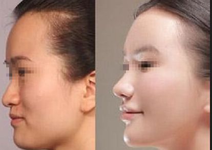 臨沂市醫(yī)美醫(yī)院排名及推薦，推薦你去哪家治療效果好