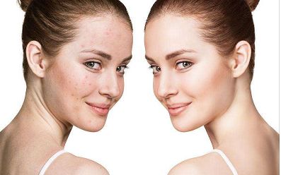 蘭州去眼袋醫(yī)院哪家好？ 一指選出專業(yè)吸脂治療