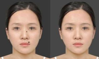 2024年重慶雙眼皮手術(shù)醫(yī)院排行榜前十，告訴你如何選擇最佳醫(yī)院