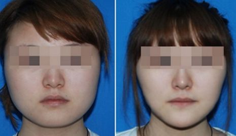 2024青島頗受好評(píng)的抽脂整形醫(yī)院推薦TOP4